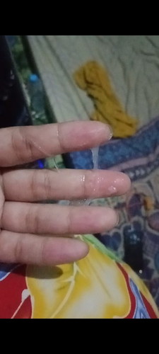 Hpl tgl 03 Oktober mau tanya kalo keluar keputihan kaya gini apa iya ada yang tau gak