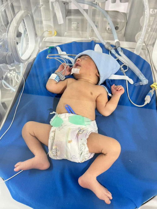 sharing bun, niatnya normal ternyata harus SC