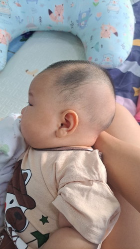 แบบนี้หัวน้องเริ่มแบนหรือเปล่าคะ