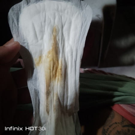na guhit ang kirot sa tagiliran pero hindi tumatagal