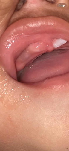 Violet sa gums