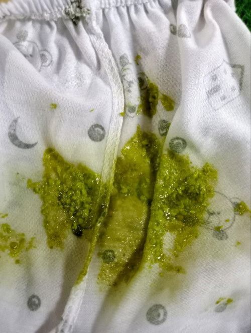 Normal tidak pup bayi 1 bulan 10 hari warna nya kek gini, maap ya bunda2 klau jorok