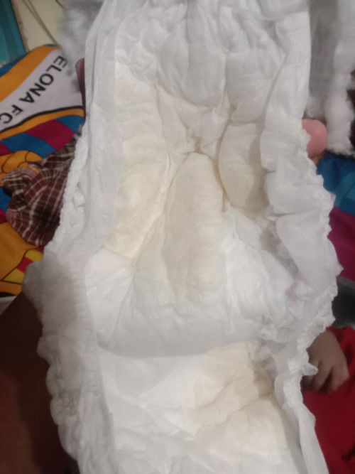 warna urin bayi 7 bulan