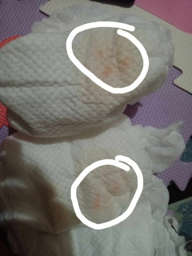 ano po ba ito nang baby po sa ihi nya po sa diaper may ganito po salamat po sa pag sagot