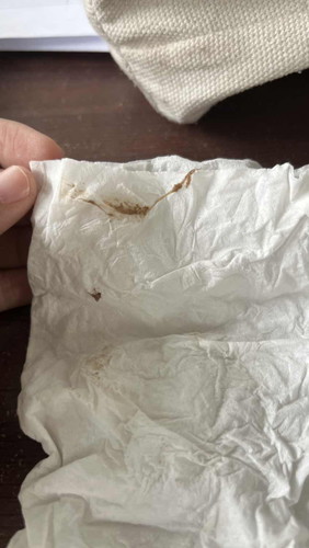 Bun ini mau tanya ini keputihan coklat atau flek ya? Saya di kehamilan 7w6d