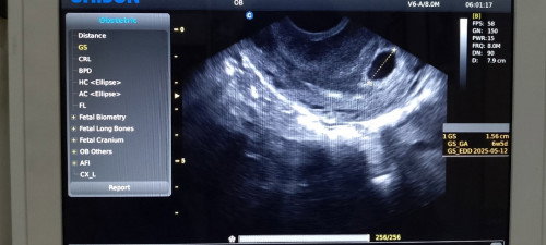 7weeks preggy po ako, nakakaranas ng pananakit ng puson at balakang. May nakaranas din po ba nito?
