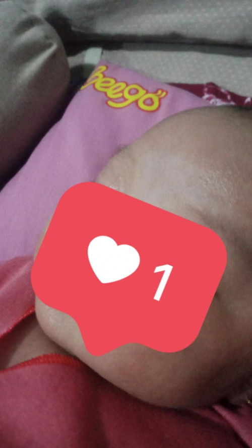 Kulit new born 1 bulan