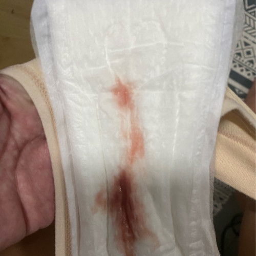 Contractions/Bleeding