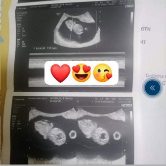 Ganito din Po ba ultrasound nyo for 9 weeks?