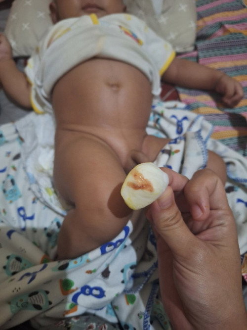 Poop bayi usia 2 bulan berwarna hijau