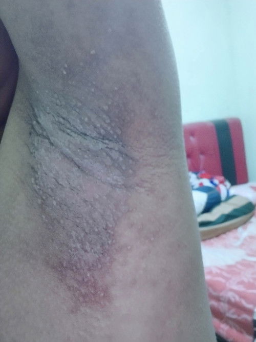 Bun ada yg udh jalan 36 week gak?