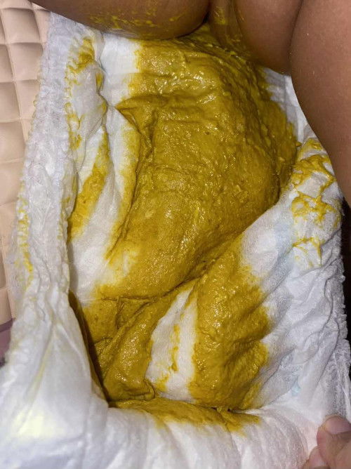 Apakah pup seperti ini diare?