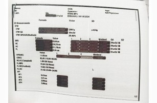 38+5 ใบซาวด์มีบอกอะไรบ้างคะแม่ๆ ใครดูเป็น บอกแม่ที
