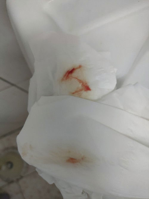 37+6 มีมูกเลือด