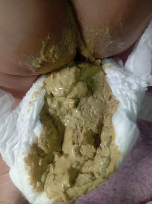 แม่ๆคะ น้อง8เดือน22วันอึแบบนี้ปกติมั้ยค้า