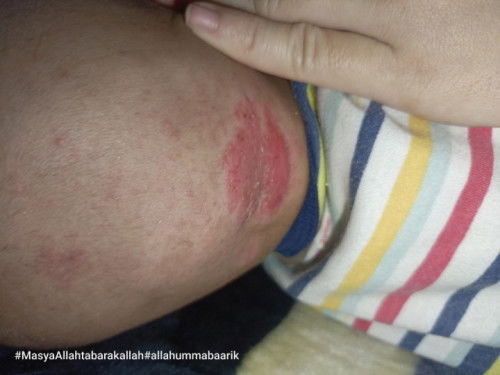 Merah dibelakang bayi