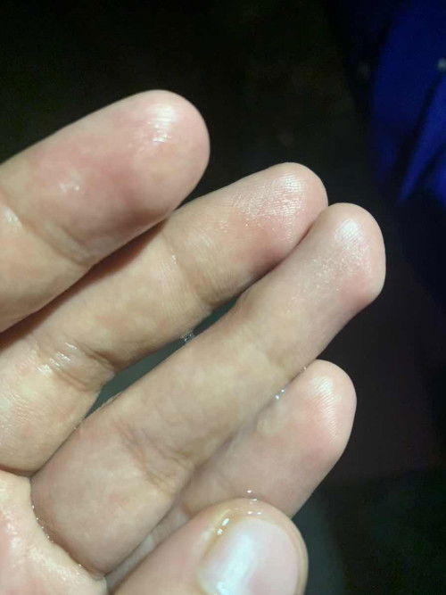 36weeks &5days preggy po