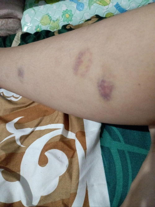 apakah seperti ini bahaya?