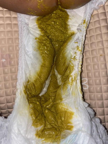 Apakah pup bayi seperti ini normal?