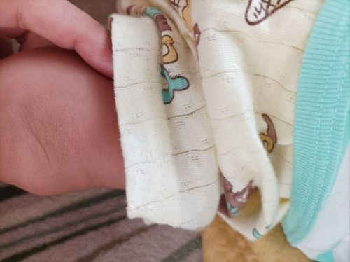 Muncul bintik kasar di kulit bayi