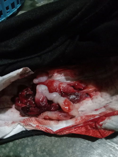 สอบถามแม่ๆหน่อยค่ะ