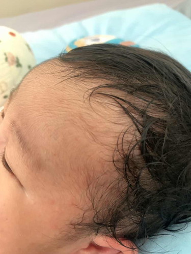 สอบถามแม่ๆหน่อยค่ะ ว่าลูกใครเคยเป็นแบบนี้