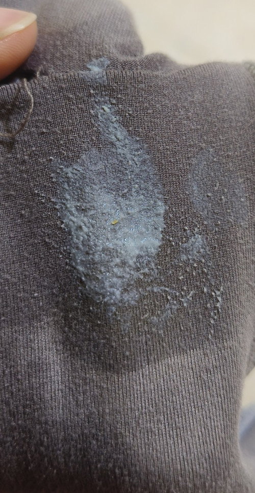 Hamil 19 weeks, KEPUTIHAN