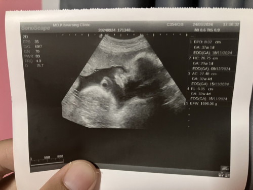 30 weeks 3day