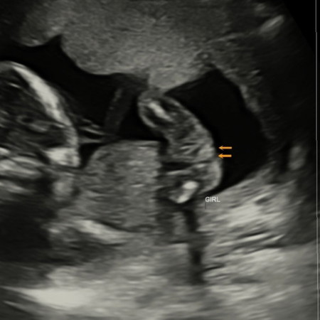 SCAN GENDER 17W