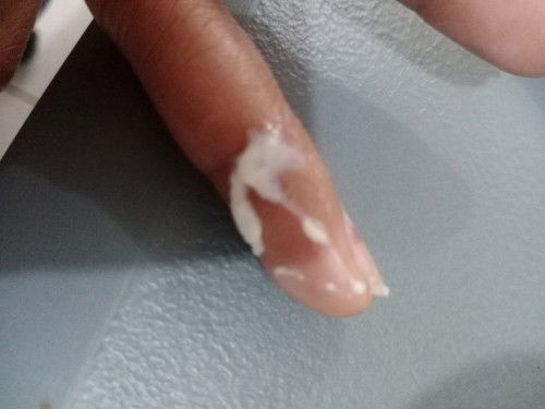 This kind of Discharged