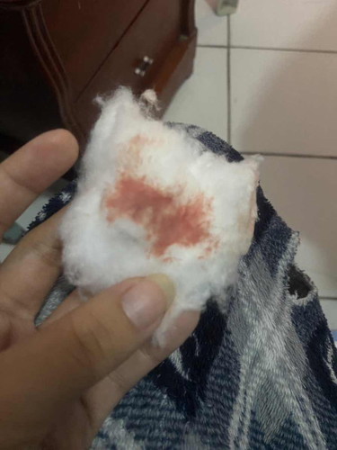 im 5 weeks ang 5 days nakaranas po ako now ng pag sakit banda sa pwet hangang now ng gabi