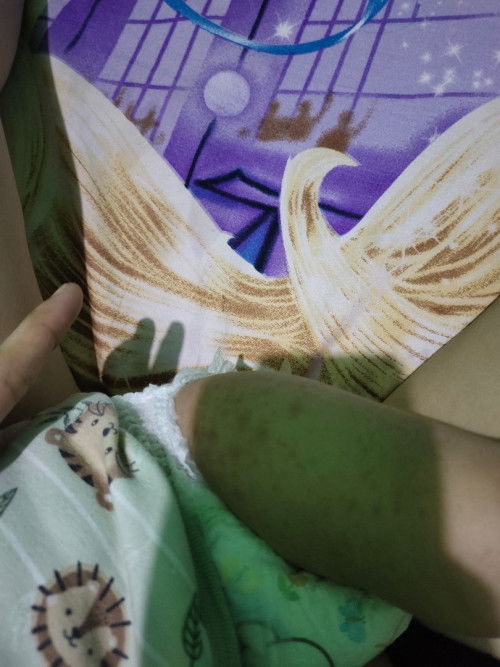 Merah merah dibagian paha dan lengan