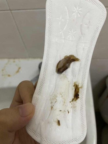 ni mucus plug ke ?