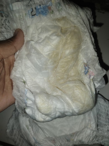 Bun pipis kek gini normal ga ya?? Soalnya dd nya kurang minum susu, gmna ya biar minum susu nya kuat
