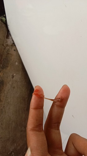 Bund aku mau tanya aku hamil 9minggu kmrn keluar kaya lendir bercak darah kecoklatan gitu knp ya bun