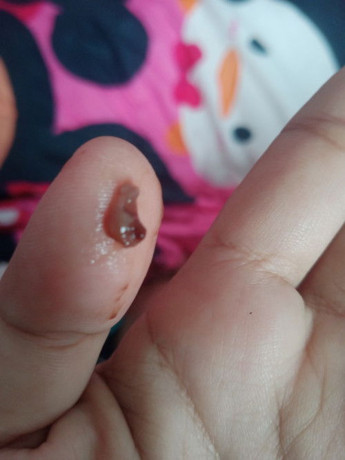 ขออนุญาติลงรูป 39+2