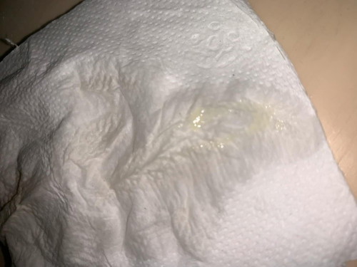 Normal Dscharge or hndi? 31weeks here