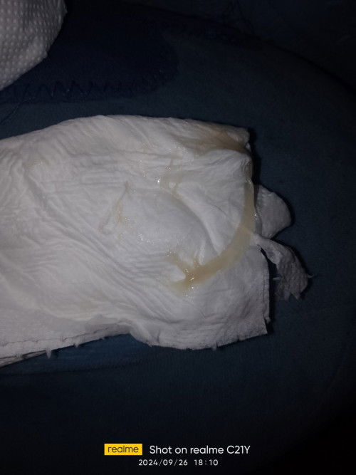 Hello po ga mima, 36 weeks and 5days po ako, mucus plug na po ba ito?