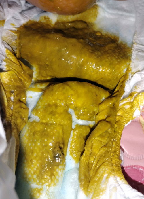 Poop (sensitive content) 7 weeks old