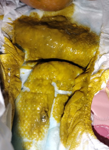 Poop (sensitive content) 7 weeks old