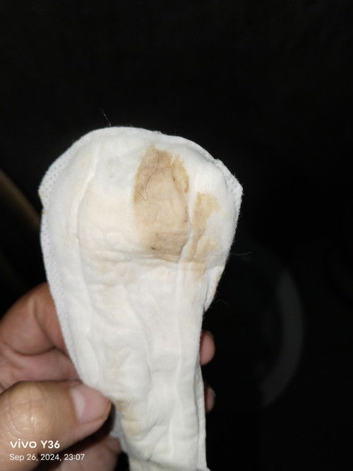 Implantation bleeding po ba ito , salamat po sa sasagot
Trying to concieve