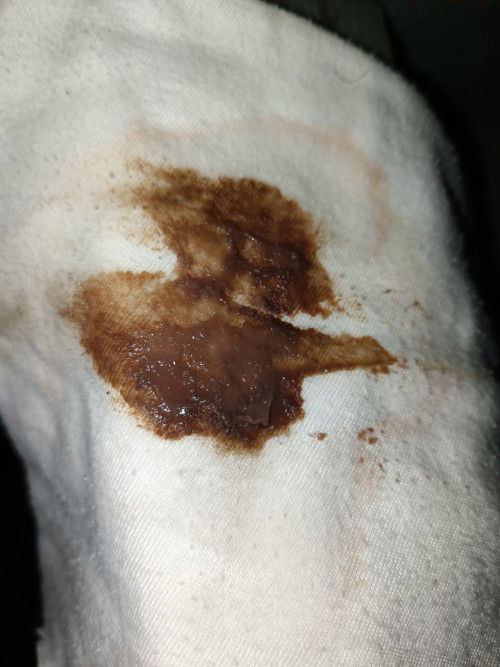 Discharge after ang IE