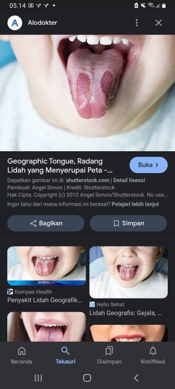 Cara penanganan