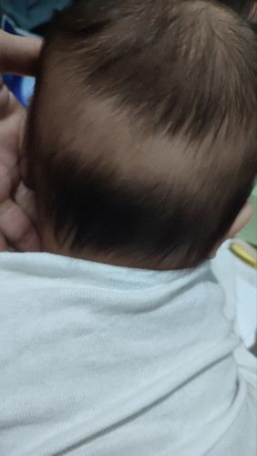 Baby's Hair Growth