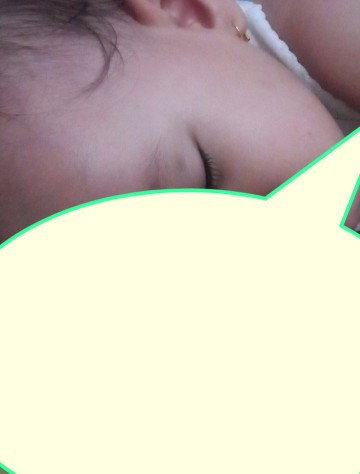 Biru pada kelopak bayi