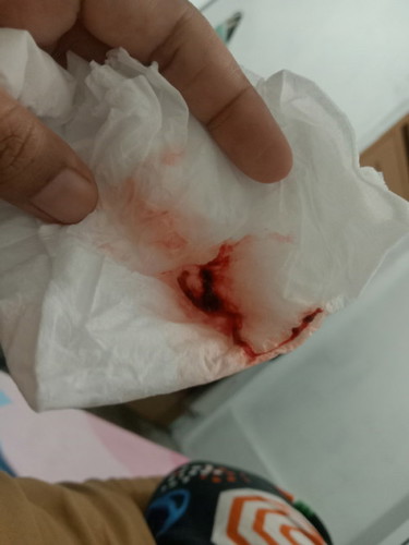 Saya hamil 6 Minggu tiba² keluar darah dan gumpalan apakah itu berbahaya apakah saya sudah keguguran