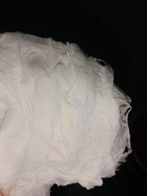 Mucus plug po ba to?