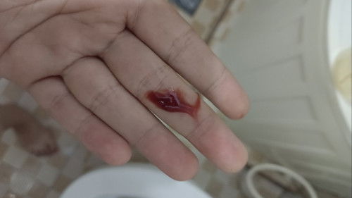 Keluar darah di minggu k 6