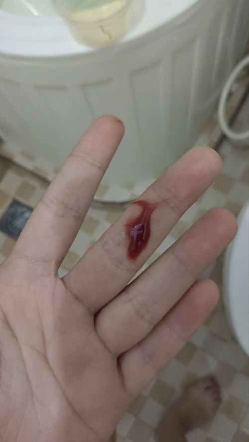 Week 6 keluar banyak darah, di USG rahimnya gaada apa2