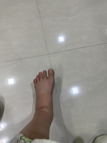 Water retention